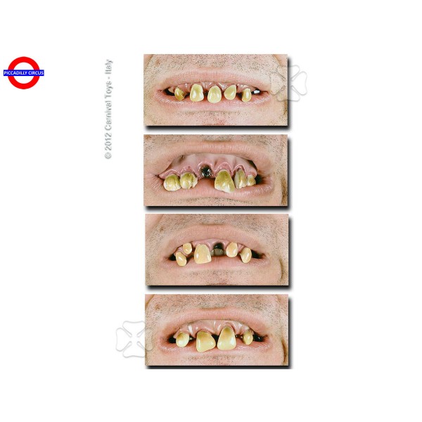 C6511 DENTIERA BAVOSA