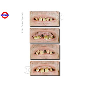 C6511 DENTIERA BAVOSA